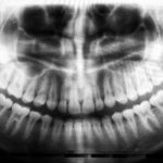 Permalink to: Alternatives to TMJ Treatments
