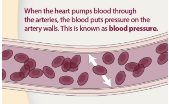 Hypertension: A Not-So-Normal (Albeit Common) Part of Aging